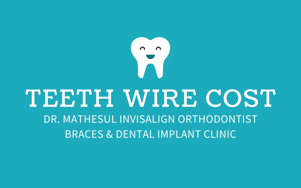 Teeth Wire Cost