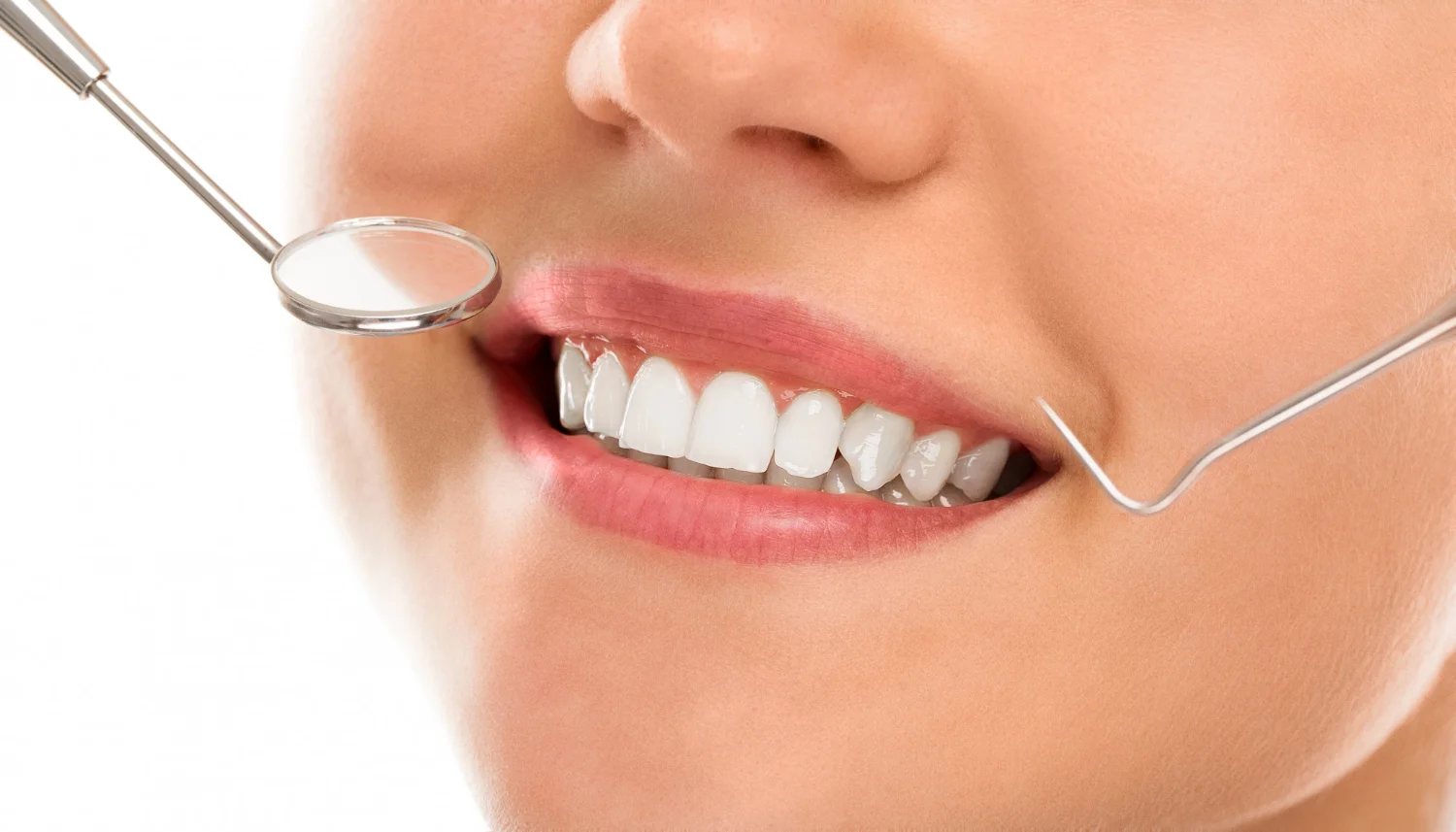 When Do You Need Teeth Whitening