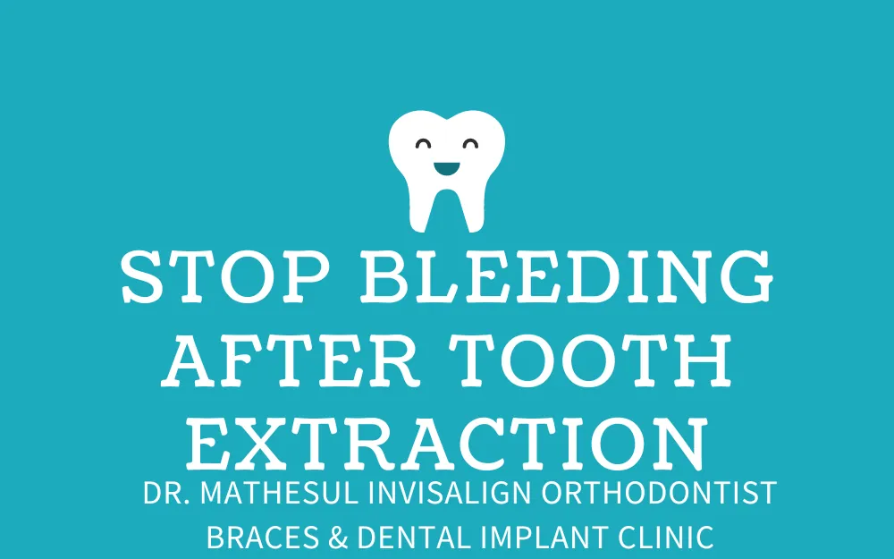 Stop Bleeding After Tooth Extraction