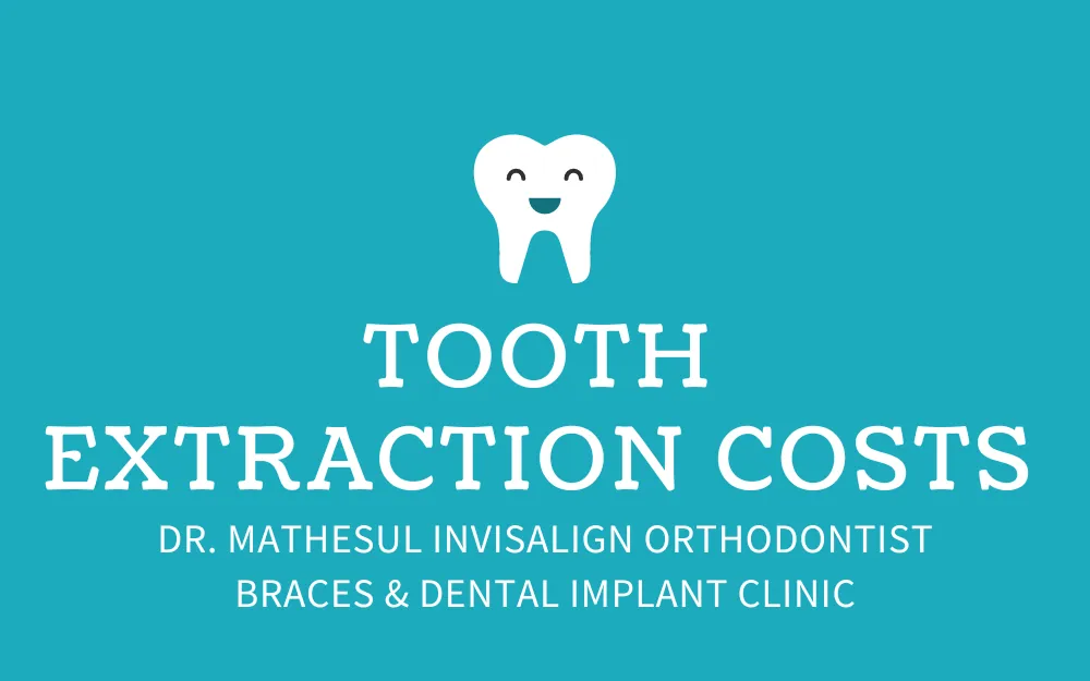 Tooth Extraction Costs