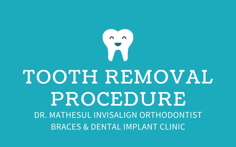 Tooth Removal Procedure
