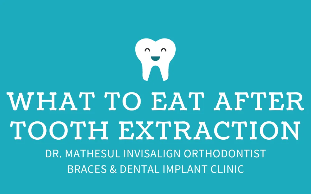 What To Eat After Tooth Extraction