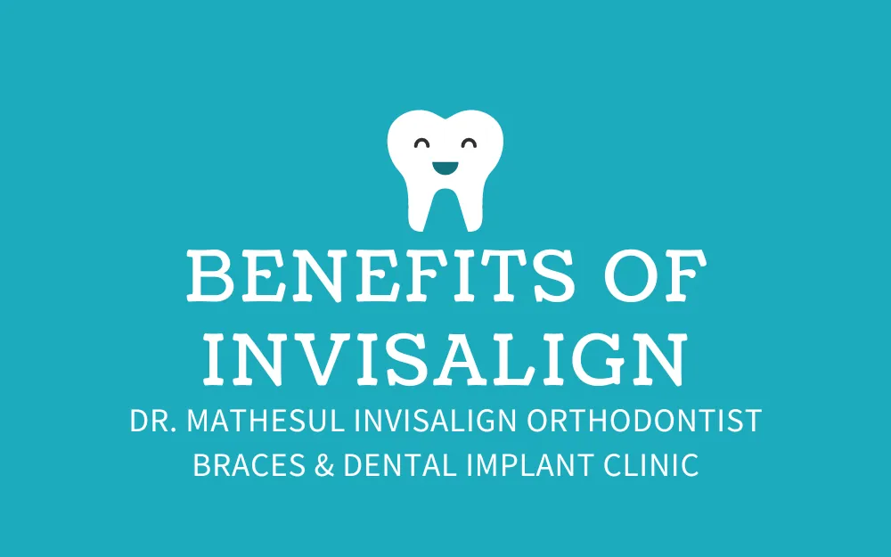 Benefits of Invisalign Over Traditional Braces