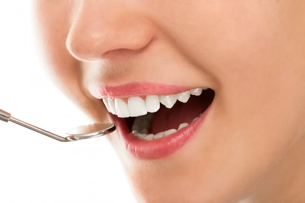 Teeth Whitening Vishrantwadi