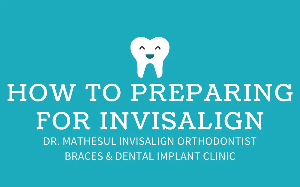 How to Preparing for Invisalign Treatment
