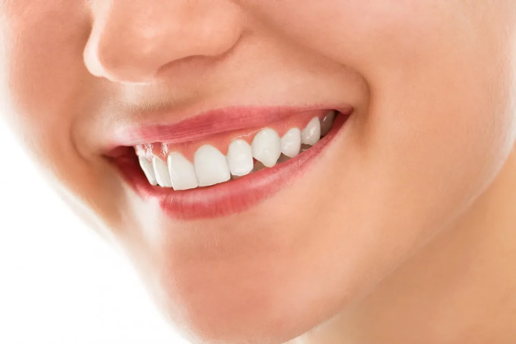 Teeth Whitening Treatment in Yerawada