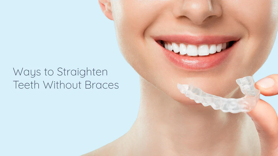 How to fix crooked teeth without Braces