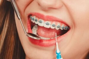Top Orthodontist Near Me in Pune – Braces & Invisalign Specialists