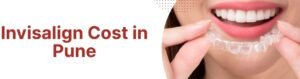 Invisalign Cost In Pune