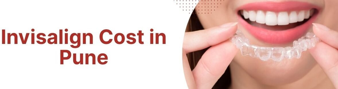 Invisalign Cost In Pune