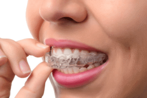 Invisalign In Pune