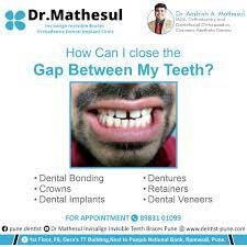 Orthodontist in Viman nagar pune 