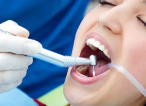 Teeth Whitening in Shastri Nagar