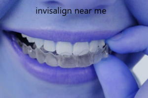 invisalign near me