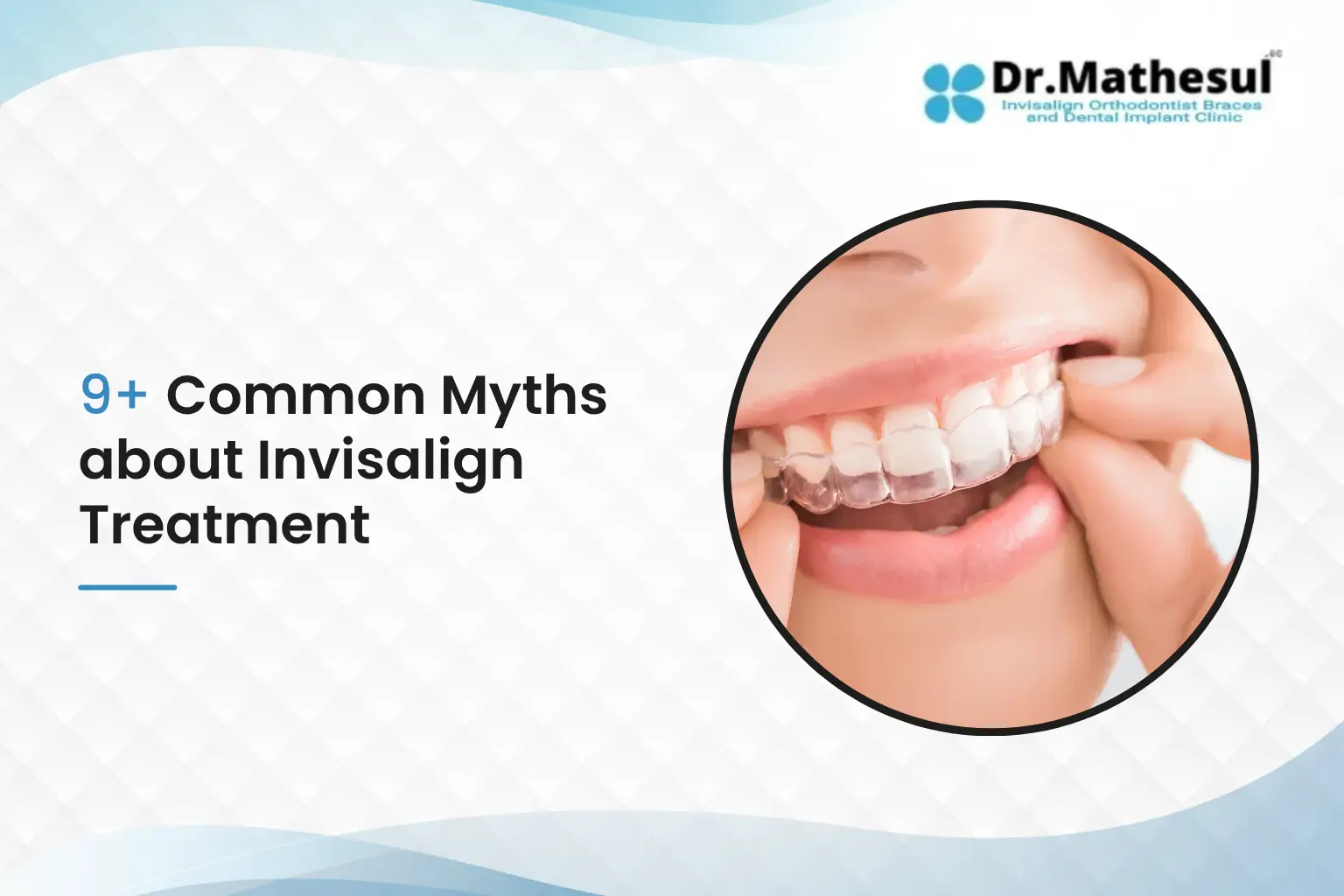 Common Myths about Invisalign Treatment