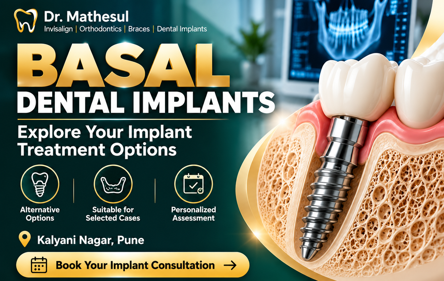 Basal Dental Implants in Pune: Cost, Procedure, Benefits and Complete Guide