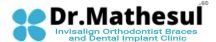 Dr.Mathesul Invisalign Orthodontist Braces & Dental Implant Clinic